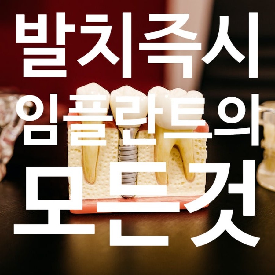 발치 즉시 임플란트 주제 카드