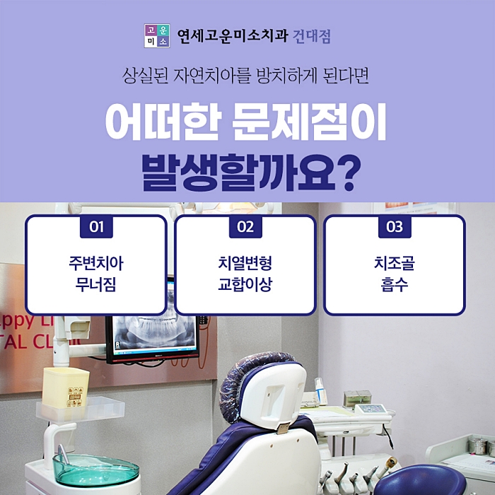 치아 상실 안내