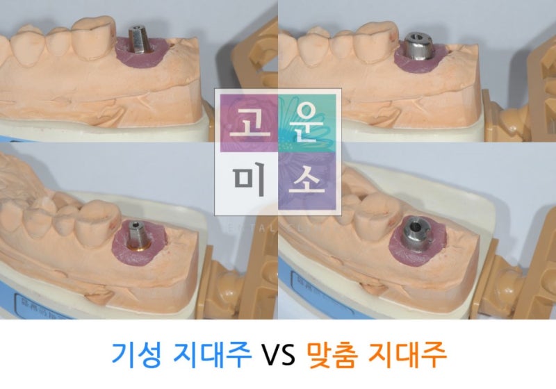 지대주 비교 도해