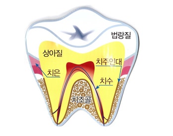 치아 구조 도해