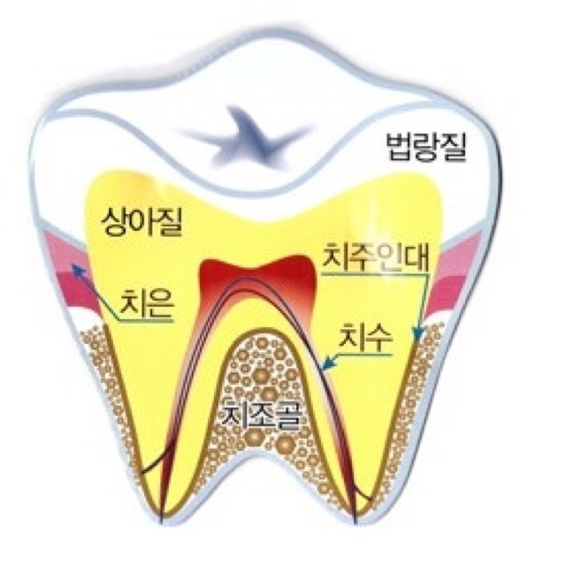 건대치아교정 유지장치, 착용 기간과 치아 되돌아감을 막는 방법