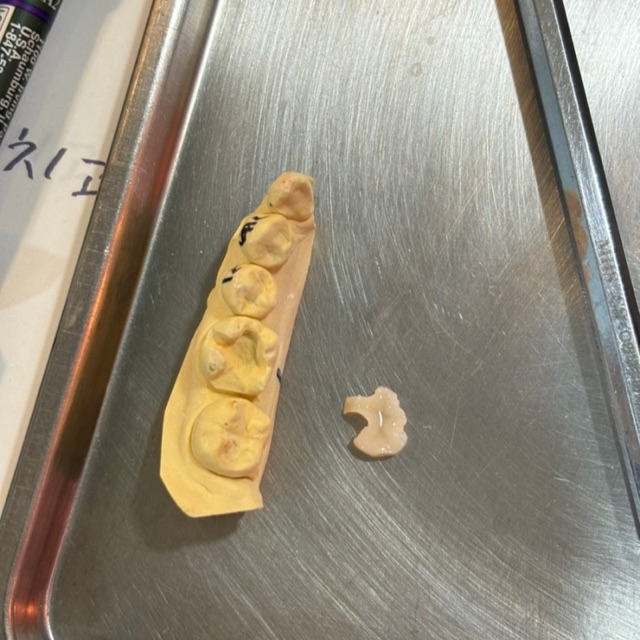 건대치과에서 보는 입안 건조함과 구강 건강의 관계