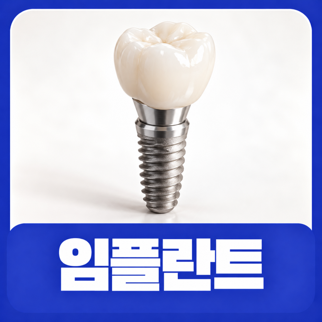 임플란트
